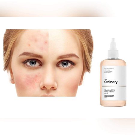 The Ordinary Glycolic Acid 7% Toning Solution 8 Ounces
